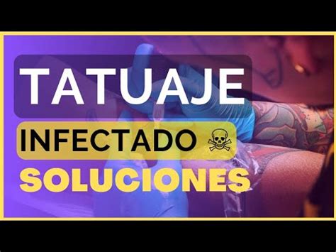 Tatuaje Infectado Y C Mo Curarlo Youtube