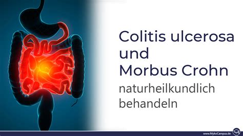 Colitis Ulcerosa Und Morbus Crohn Naturheilkundlich Behandeln MykoCampus