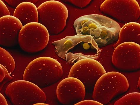 Malaria Information, Facts and Photos | National Geographic