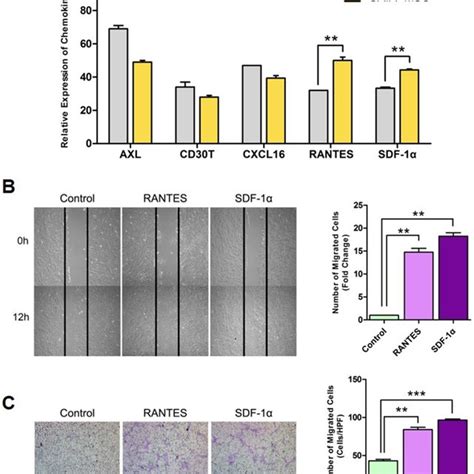 Sdf 1α And Rantes Induced By Msc Treatment Promote Migration Of Mscs Download Scientific