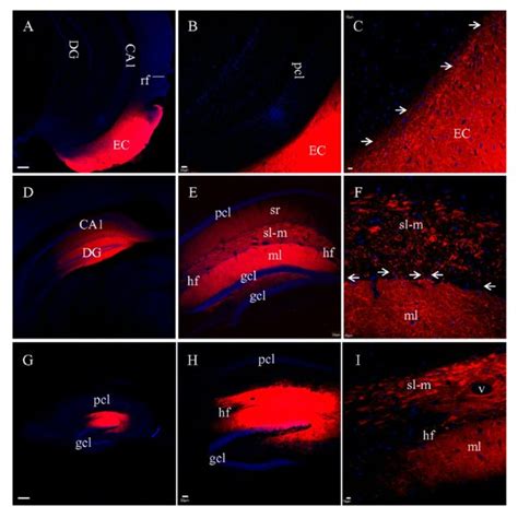 Pp Fibers Labeled By Dii Injected Into Fixed Coronal A F Or