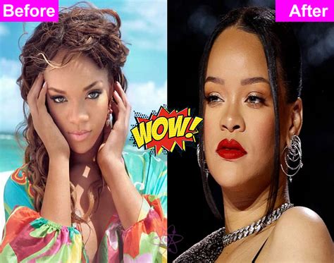 Rihanna Plastic Surgery And Transformations Celebscience