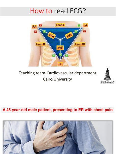 How To Read Ecg Pdf Electrocardiography Internal Medicine