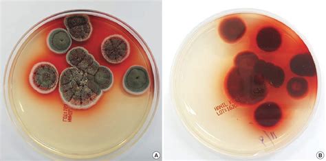 Figure From Penicillium Species Other Than Talaromyces Marneffei