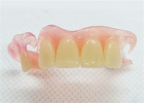 flexible partial dentures dental lab direct