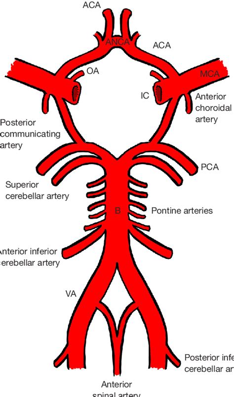 Aneurysm Of Vertebral Artery Ct Scan Stock Image C035