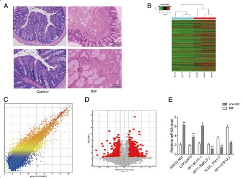 Microarray Screening Of Alterations In The Lncrna Expression Profiles