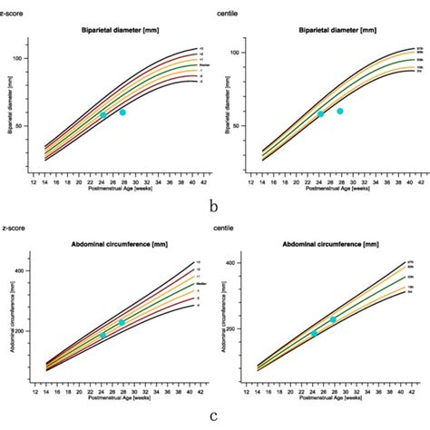 Fetal Biometry Charts Of Fetal Growth Based On Intergrowth 21st Download Scientific Diagram