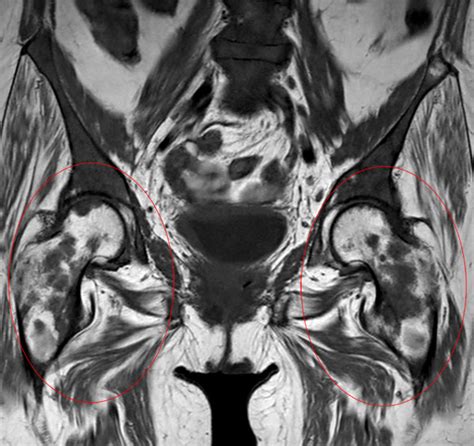 Total Torso Imaging Philips Mr Body Map