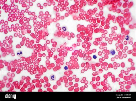 Human Blood Cells Stained Brightfield Photomicrograph Stock Photo Alamy