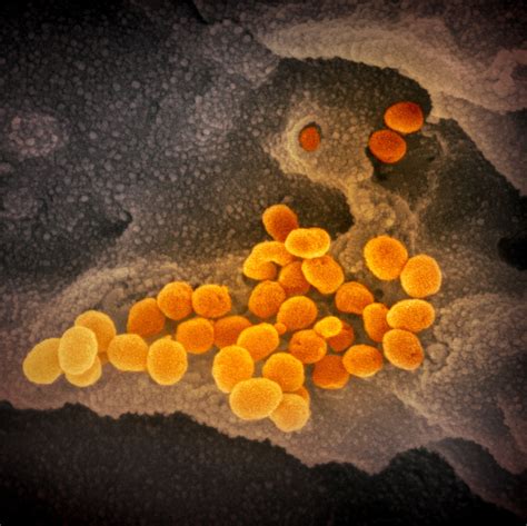 IMAGES: What New Coronavirus Looks Like Under The Microscope | NCPR News