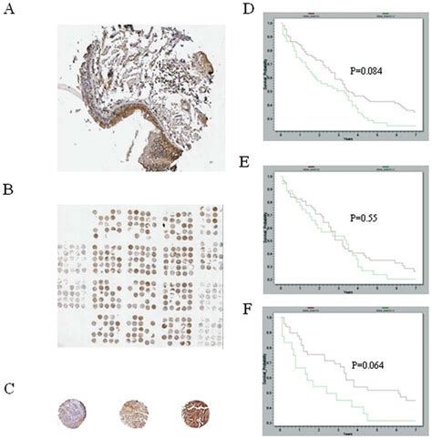 Representative Immunohistochemical Analysis Using The TUSC1 Antibody In