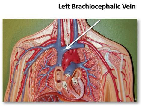 Left Brachiocephalic Vein The Anatomy Of The Veins Visua Flickr