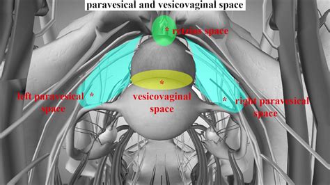 Pelvic Surgery Anatomy Space Youtube