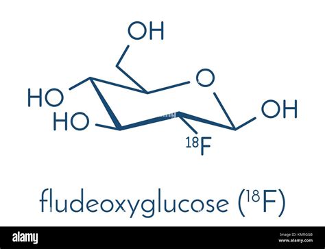 Fludeoxyglucose 18F Fluorodeoxyglucose 18F FDG Cancer Imaging