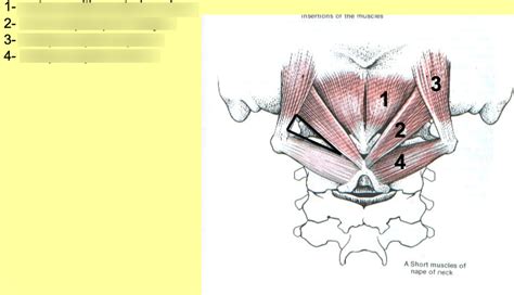 Suboccipital Triangle Diagram Quizlet