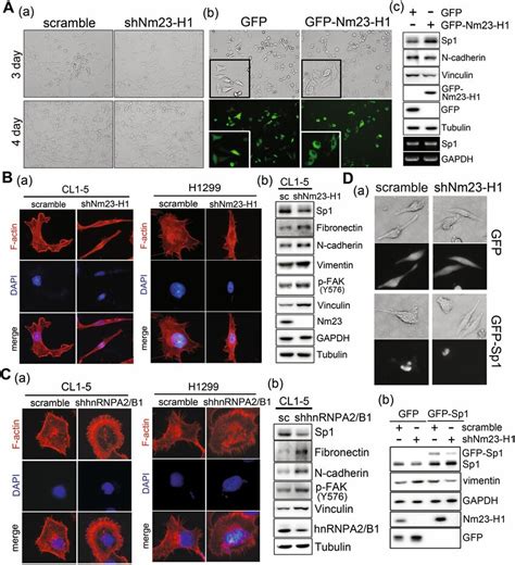 The Role Of Nm23 H1 Mediated Sp1 Expression In The Epithelial And