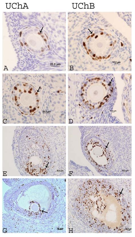 Immunostaining For Ki 67 In Different Stages Of Ovarian Follicular