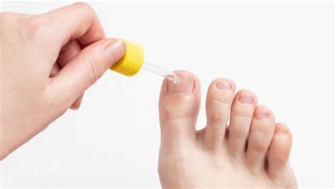 El mejor tratamiento para eliminar los hongos en las uñas de los pies