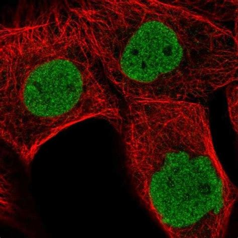 Mdfi Polyclonal Antibody Invitrogen™ 100 μl Unconjugated Fisher