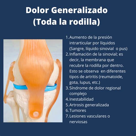 Qué estructuras duelen en la rodilla Dr Luis Calderón S