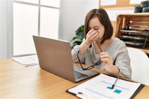 Brunette Woman With Down Syndrome Working Tired At Business Office