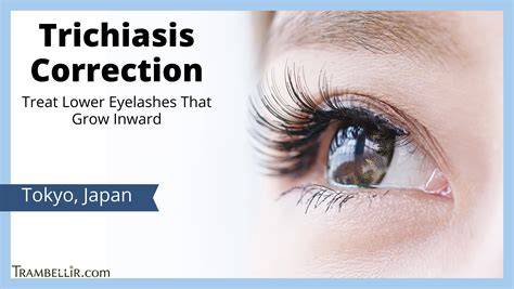 Trichiasis Correction (Treat Lower Eyelashes That Grow Inward) | Trambellir