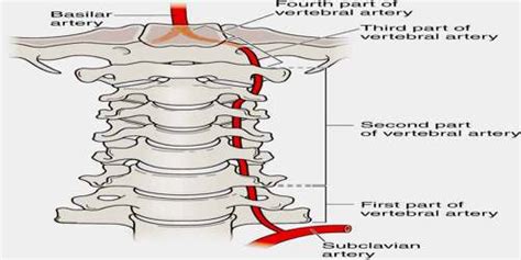 Vertebral Artery Assignment Point