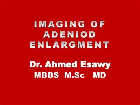 Dr Ahmed Esawy Imaging Of Adeniod Enlargment Ppt