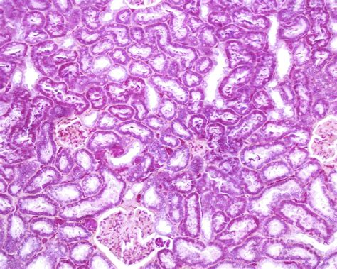 Kidney Cortex Photograph By Jose Calvoscience Photo Library Pixels