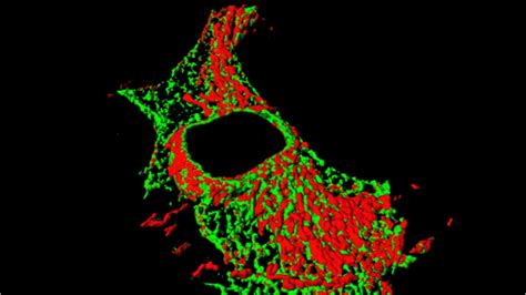 Mitochondria Associated Membranes Mams And Pathologies