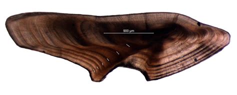 Image Of A Representative Transverse Otolith Section With Annual