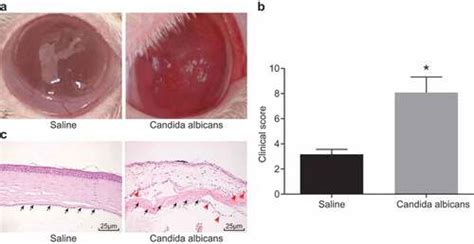 Full Article Il 17 Produced By Th17 Cells Alleviates The Severity Of Fungal Keratitis By