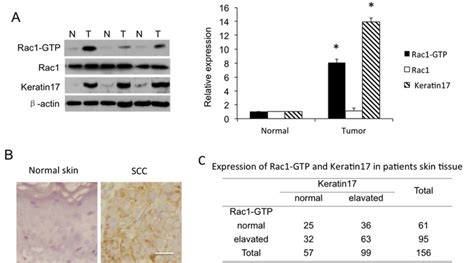 Rac Activity As Rac Gtp And Rac And Keratin Expression In Human