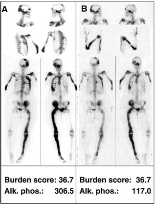 Figure Effect Of Pamidronate Treatment A Representative Set Of Pre