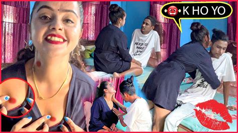 Hickey Prank On My Husband 💔to See How He Reacts😡मेरो Hickey देखेर