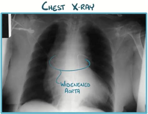 Cardiac Emergencies Flashcards Quizlet