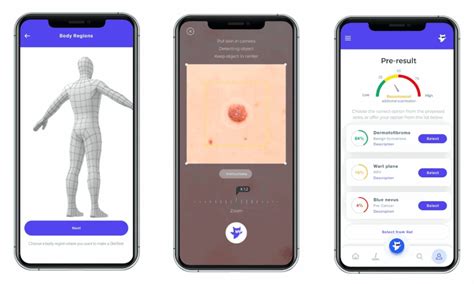 Mole Mapping Online Ai Dermatologist