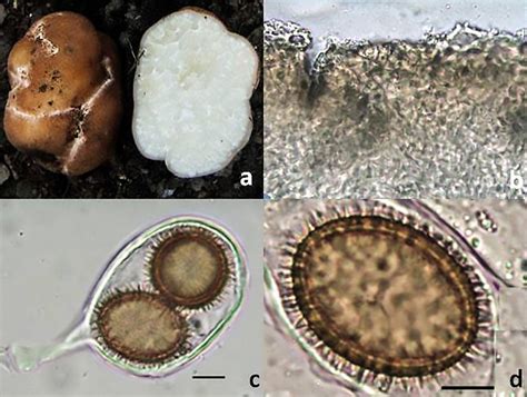 Tuber Ferrugineum TARC AT 2279 A Ascocarp B Peridium C Ascus