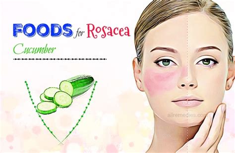 List Of 34 Best And Worst Foods For Rosacea Do You Know