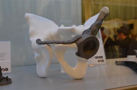 A Titanium 3d Printed Hip Implant From Eos Prints 3d Printing Novelty Lamp