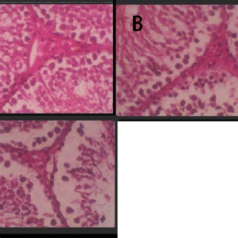 Histology Of Leydig Cells A Negative Control B Treatment 1 With