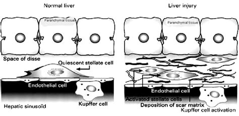 Diagram Depicts 4 Major Liver Cell Types Parenchymal Cells