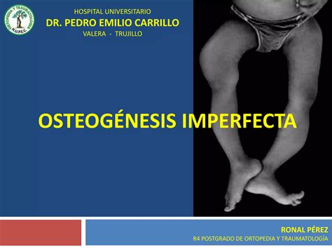 Osteogenesis Imperfecta PPT