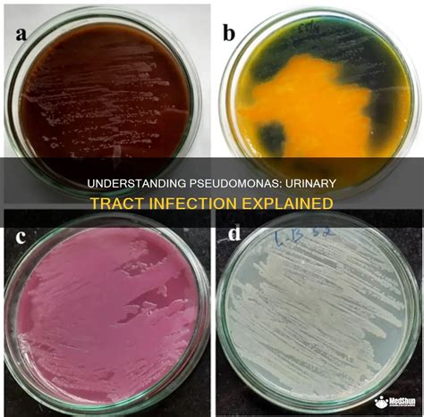 Understanding Pseudomonas Urinary Tract Infection Explained Medshun