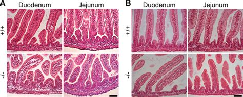 Duodenum Jejunum Ileum Histology