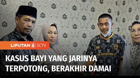 Sctv On Twitter Kasus Jari Bayi Terpotong Saat Menjalani Perawatan Di