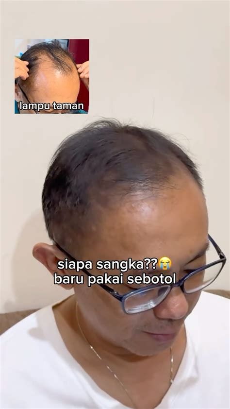 sh  shampoo official ga  kulit muka  bikin tua rambut