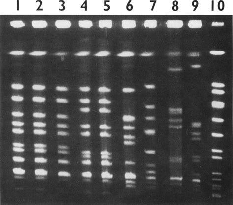 Pulsed Field Gel Electrophoresis Patterns Of Sma I Digested Chromosomal