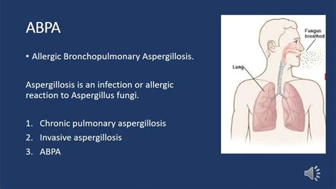 Abpa Allergic Bronchopulmonary Aspergillosis Youtube